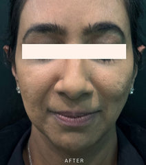 After Image