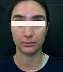 After Image