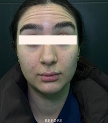 Before Image
