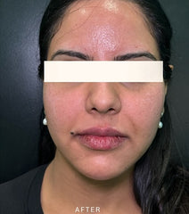 After Image