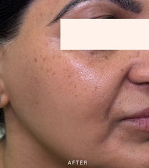 After Image