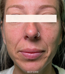 Before Image