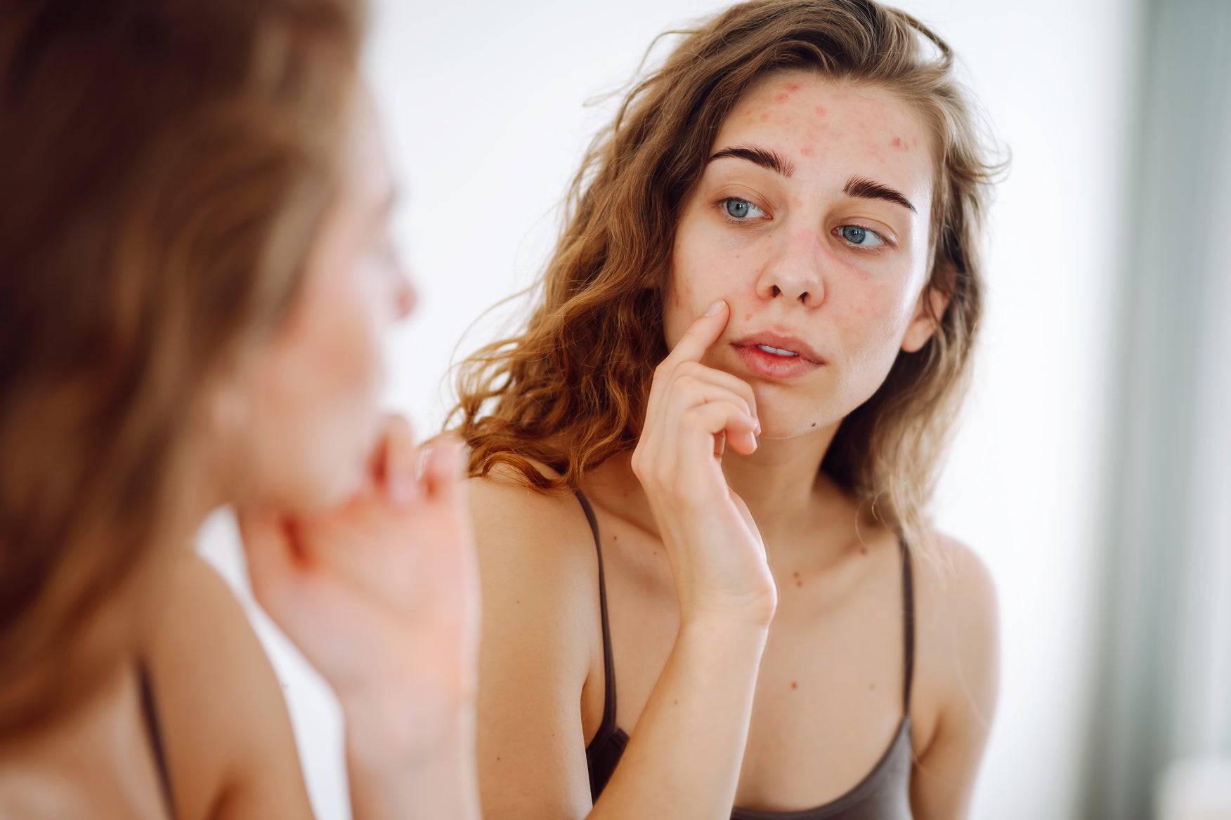 Clear Skin, Smooth Texture — Banish Breakouts and Scars for Good