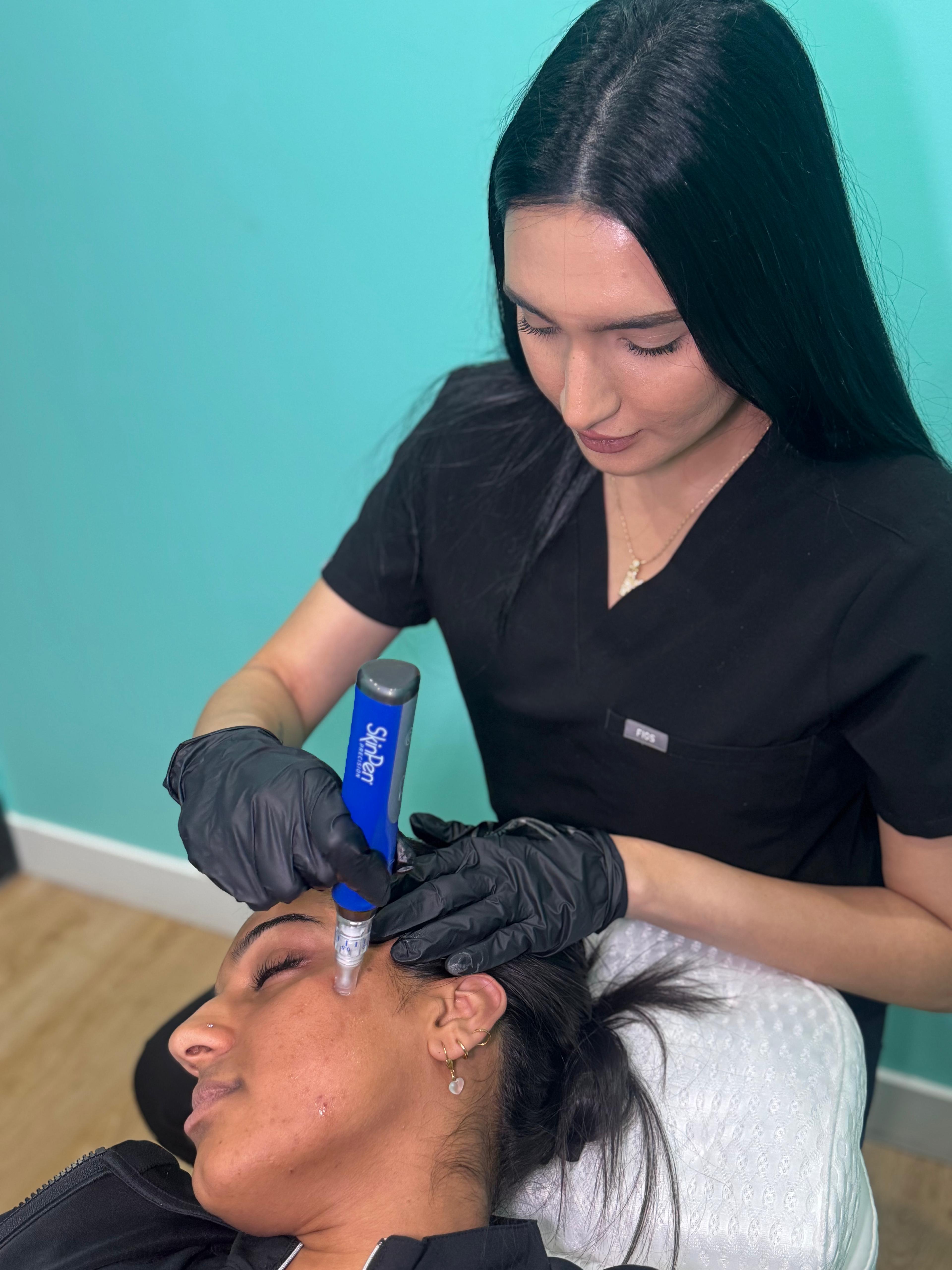 SkinPen Microneedling