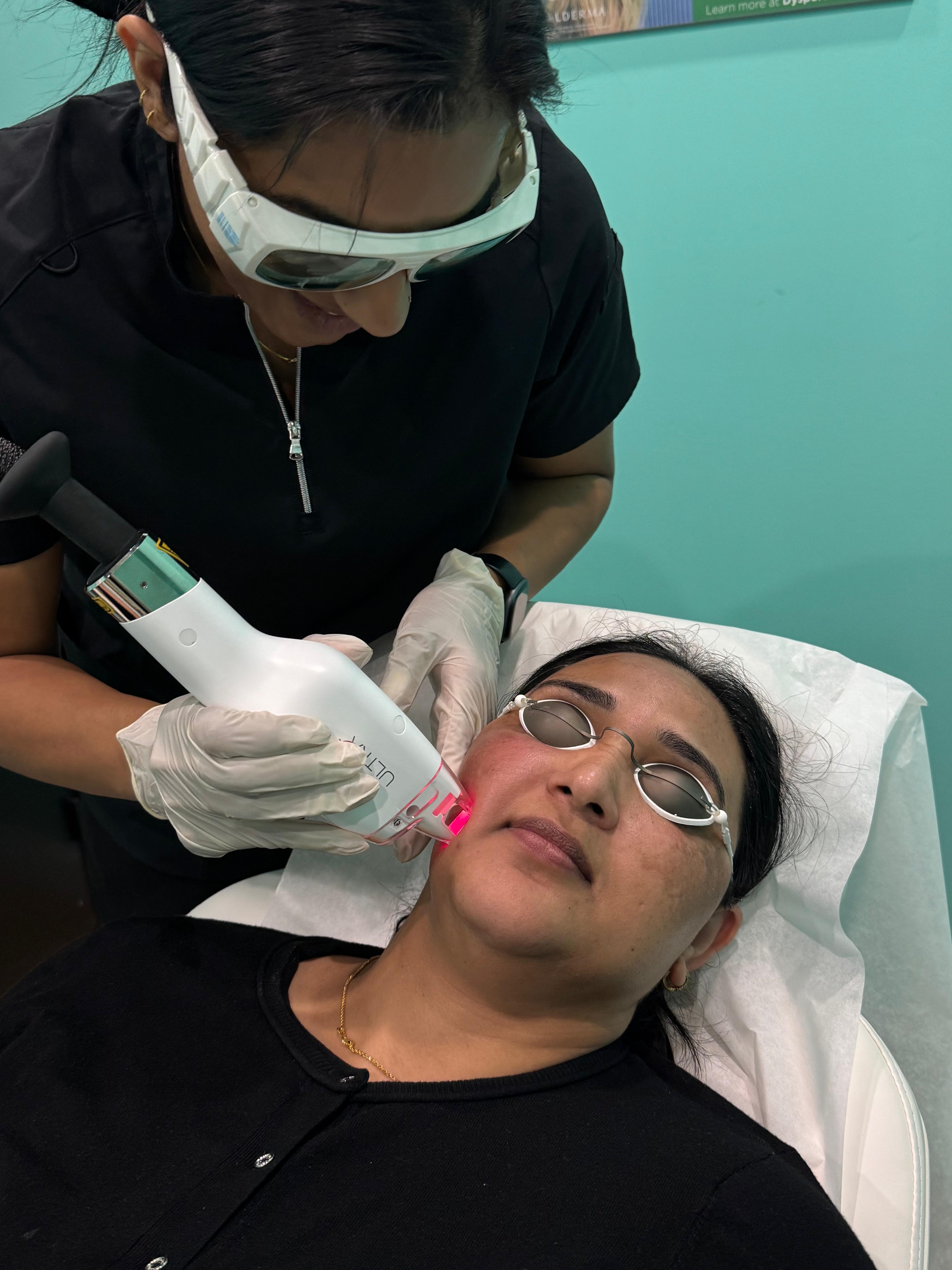 Lutronic Ultra LaseMD