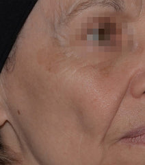 After Image