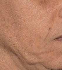 After Image