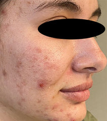After Image