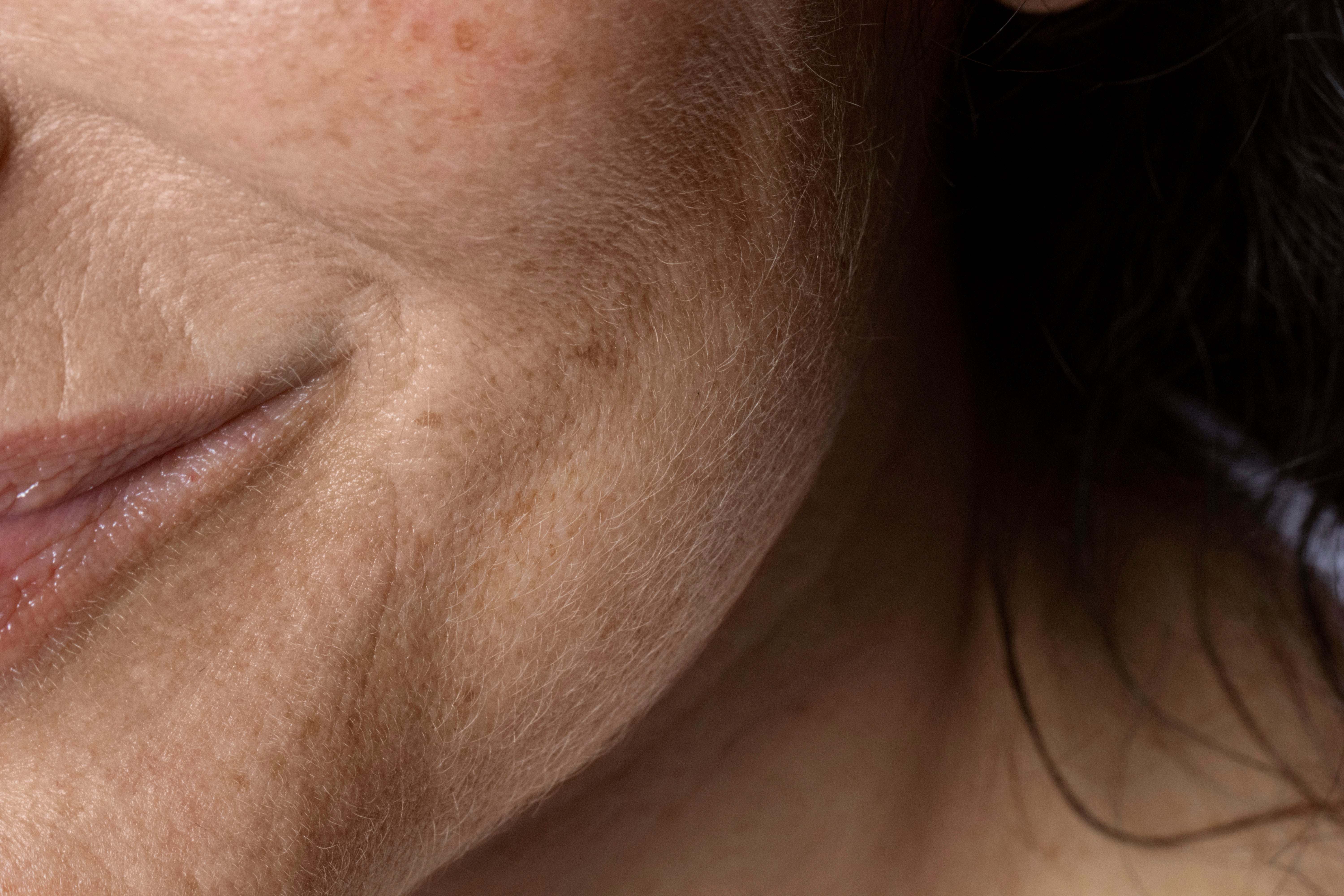 Rehydrate. Restore. Reveal Your Radiance.