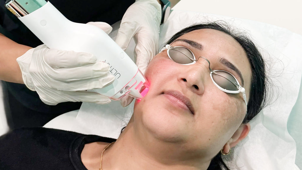 Say Goodbye to Dark Spots: A Guide to Treat Uneven Pigmentation with LaseMD Ultra